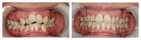 Beforeandafter Gallery