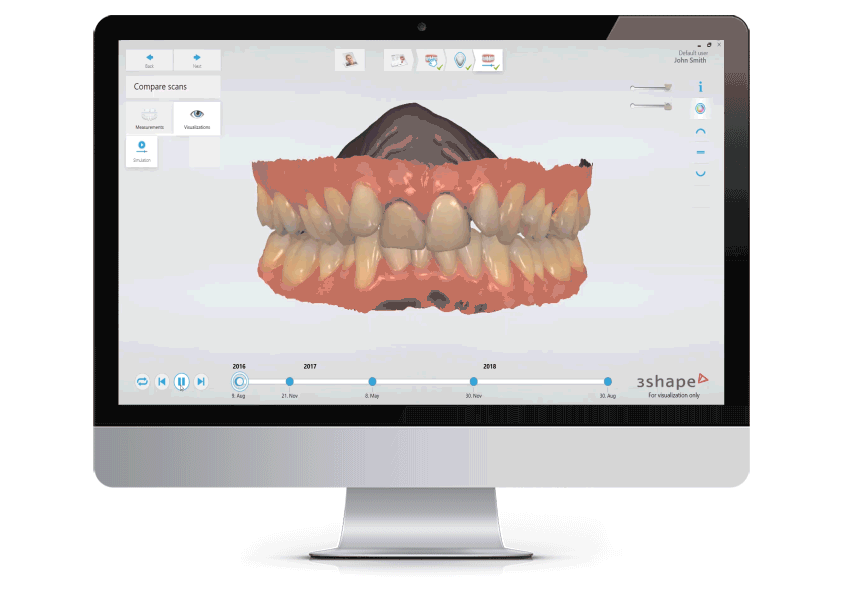 Dental Scan 3Shape TRIOS